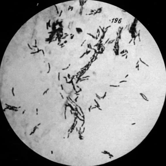 Tuberkulose-Erreger unter dem Mikroskop